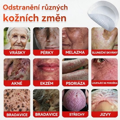 🔥✅GFOUK® Mikrojehličková botanická náplast na odstranění bradavic